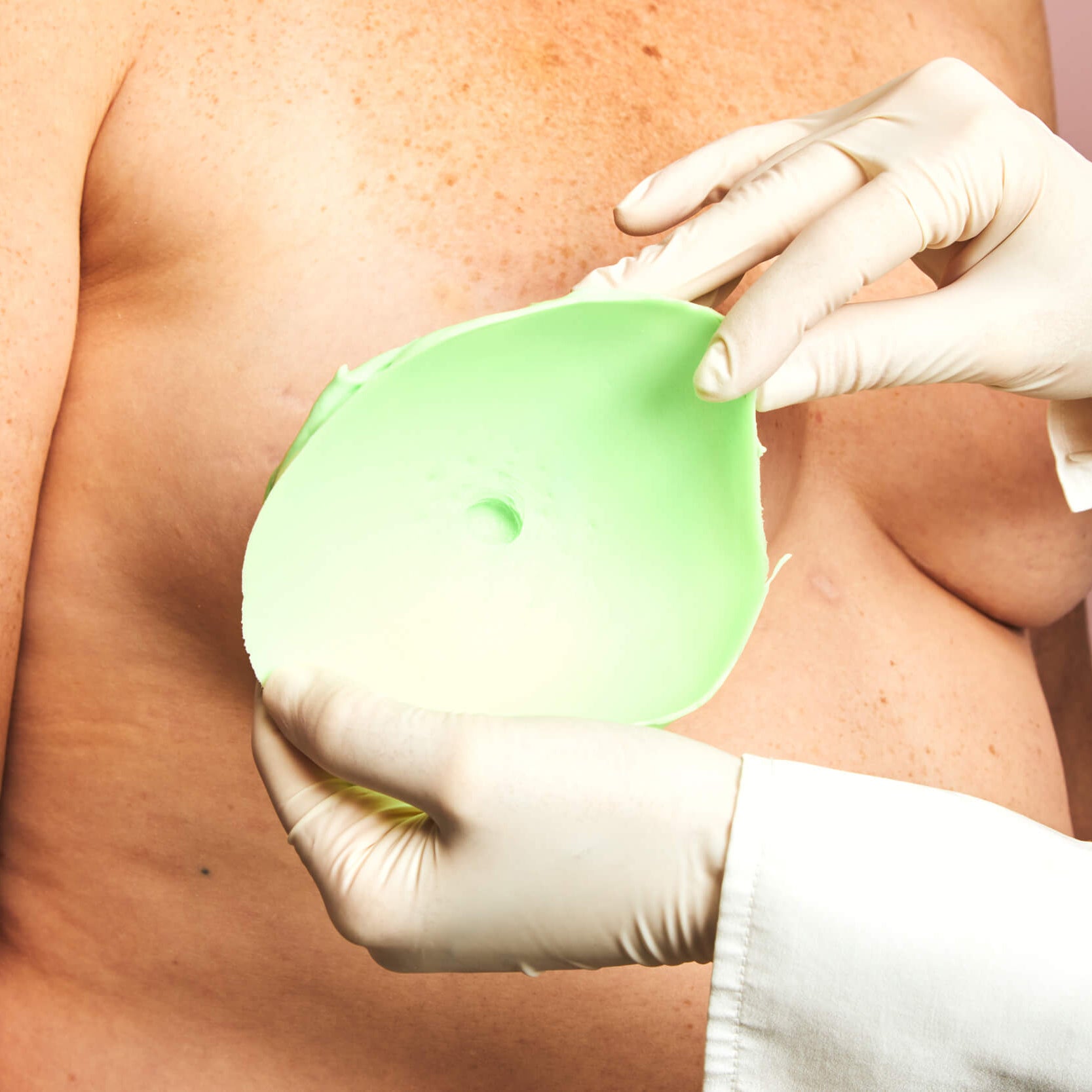 Molde Pré-Cirurgia – Atendimento Presencial