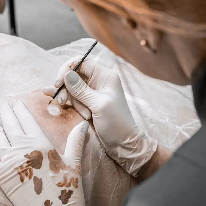 What Is Areola Micropigmentation — and Is It the Same as a Tattoo?